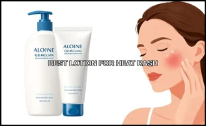 Best lotion for heat rash